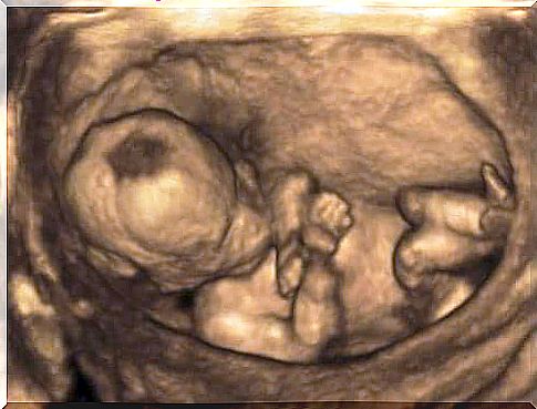 Ultrasound of a baby