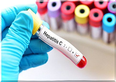 Hepatitis C during pregnancy: risks and treatment