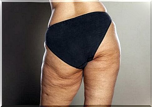 Some tips to fight cellulite