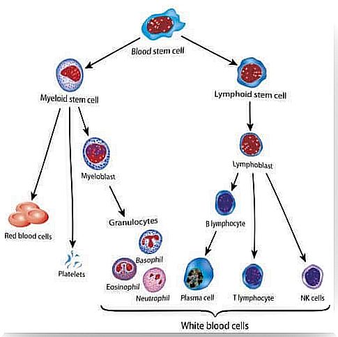 Explanatory diagram of the different types of leukemia